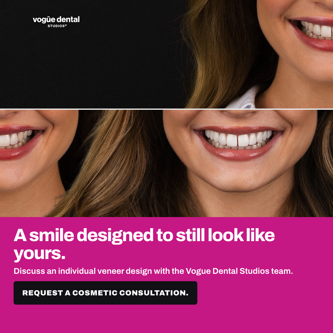 First finished Vogue Dental Studios image ad
