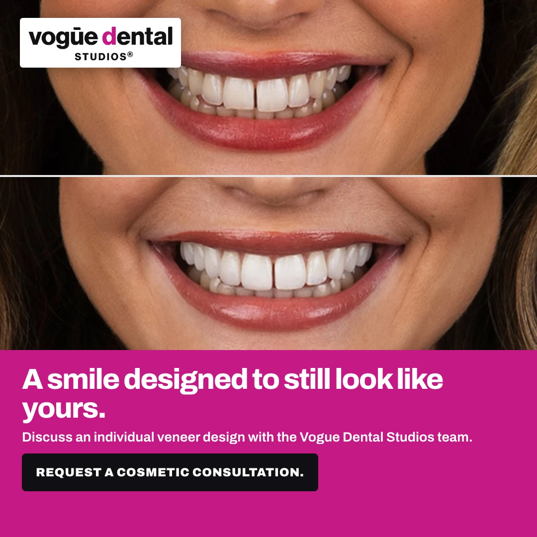 Individual smile design ad creative